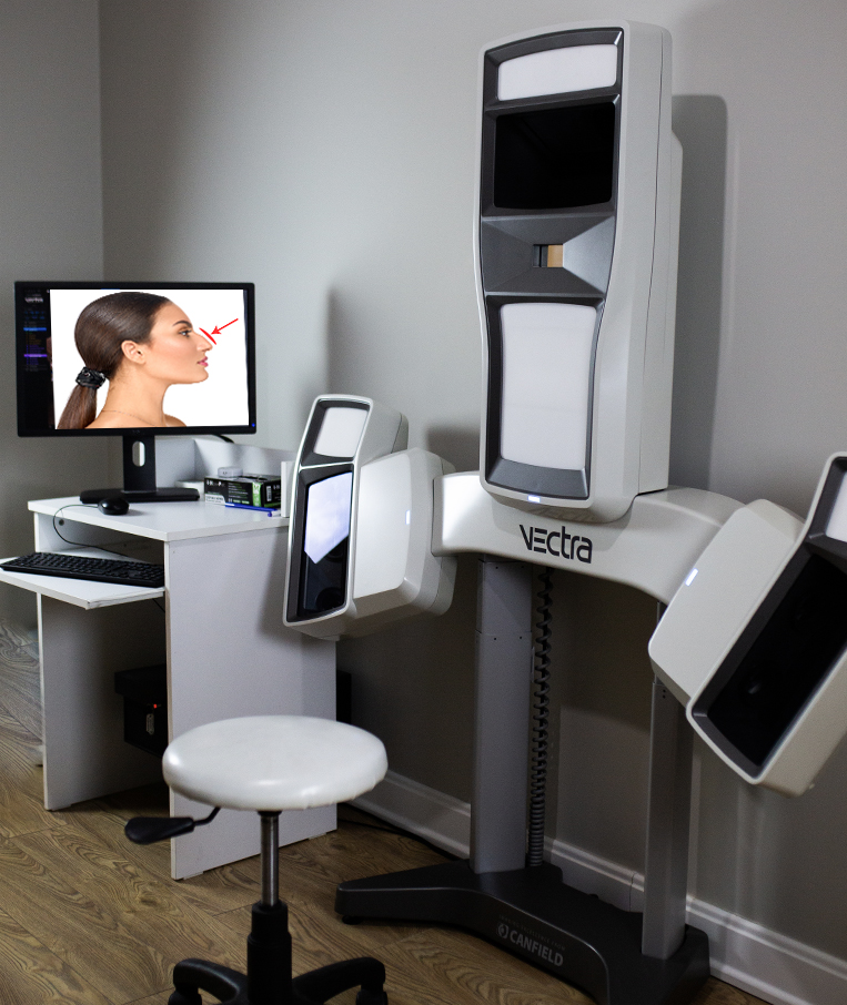 3d Vectra ile burun estetiği ameliyatı olmadan önce burnunuzun ameliyat sonrası nasıl görüneceğini görebilirsiniz. Size en yakışan burun tipin seçebilirsinizi. Sürprizlerle karşılaşmayın.